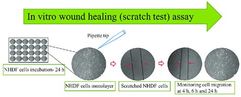 scratch test assay|scratch assay for wound healing.